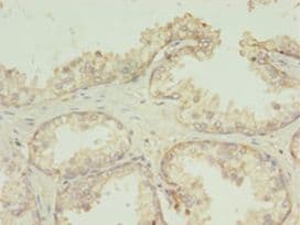 TMEM141 Antibody (aa1-108)