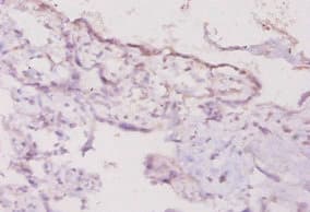 Polyclonal Rabbit anti-Mouse IFN Gamma / Interferon Gamma Antibody (WB)