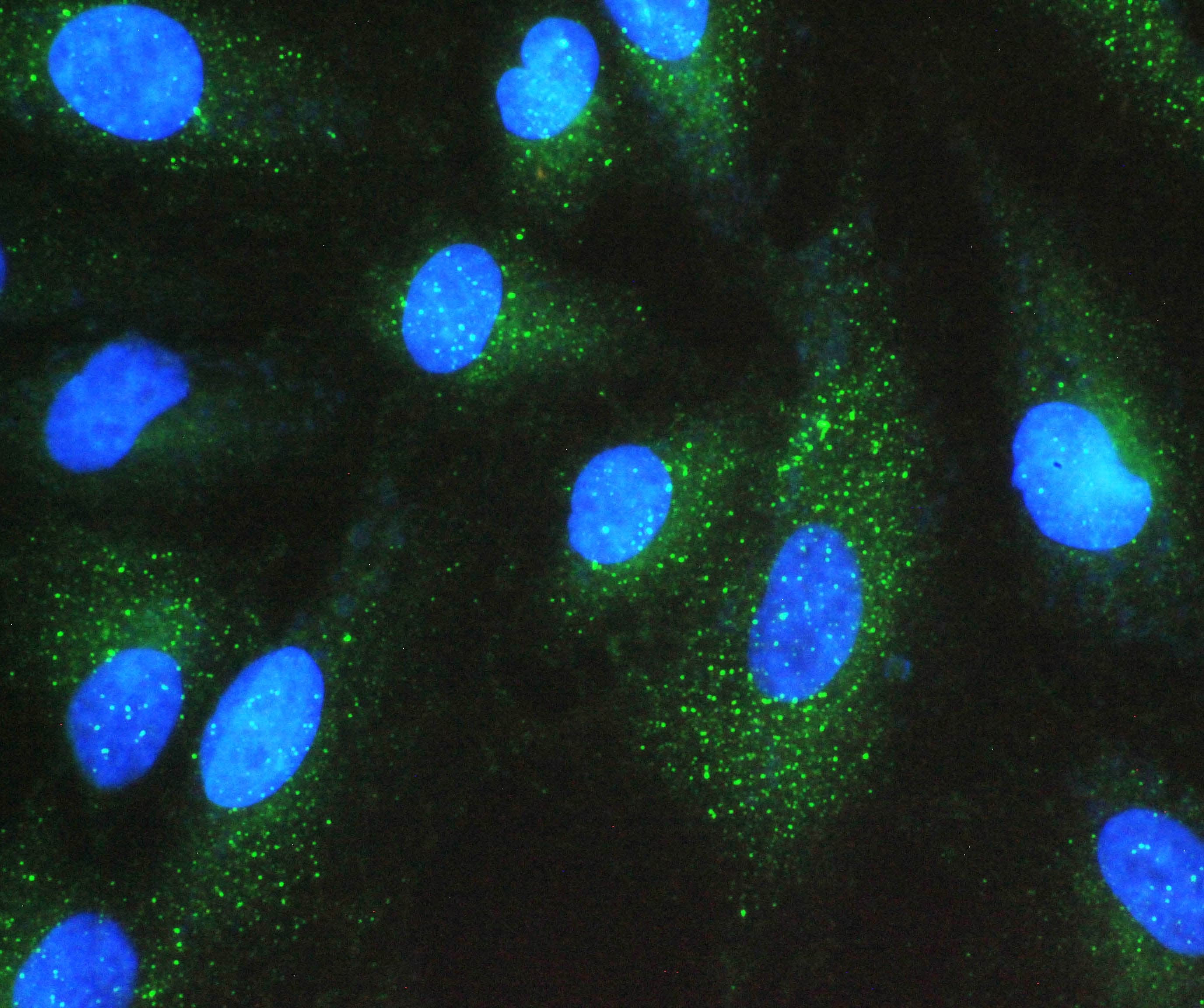 Polyclonal Rabbit anti-Human GNB1 Antibody (IHC, WB)