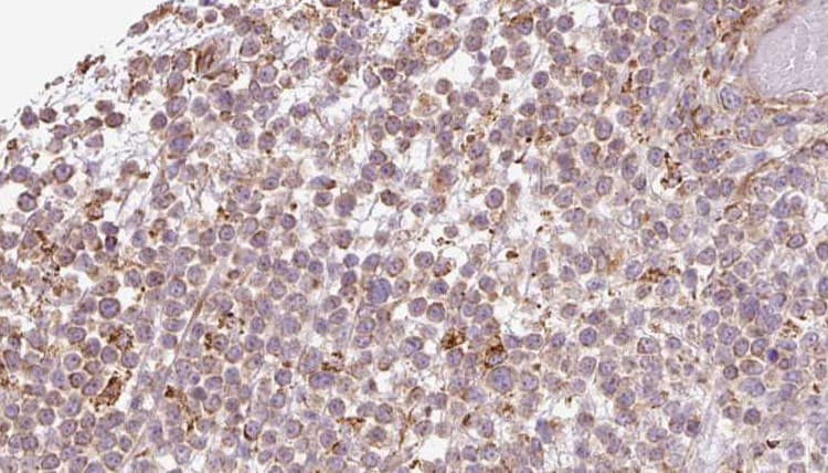 Polyclonal Rabbit anti-Human ATP8A1 Antibody (IHC, WB)