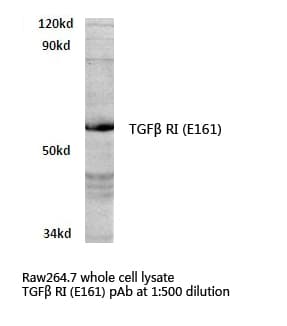 TGFBR1 / ALK5 Antibody (Glu161)