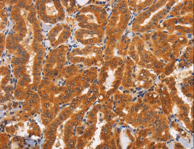 CD30 Antibody