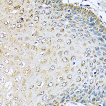 Polyclonal Rabbit anti-Human KCTD15 Antibody (IHC, WB)