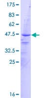 Human AVPI1 Protein (Recombinant GST)