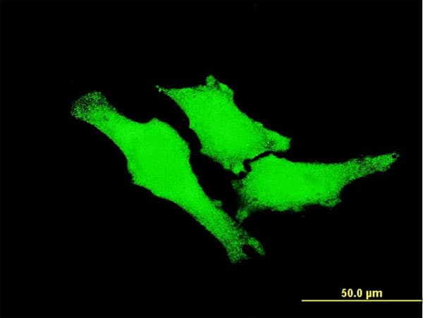 ERBB2 / HER2 Antibody (clone 4E1)