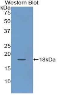 KRT19 / CK19 / Cytokeratin 19 Antibody (aa245-391)