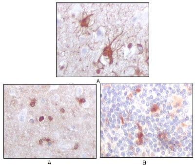 S100B / S100 Beta Antibody (clone 9A11B9)