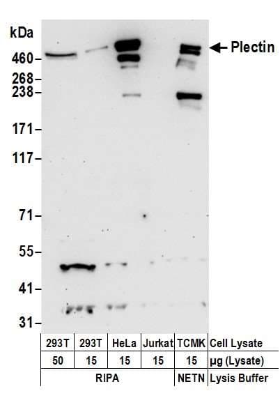 Polyclonal Rabbit anti-Human PLEC / Plectin Antibody (aa4534-4684, WB)