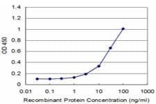 Monoclonal Mouse anti-Human PCP4 / PEP19 Antibody (clone 1E3, WB)