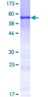 Human KRT35 / Keratin 35 / KRTHA5 Protein (Recombinant GST)