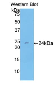TNNI1 Antibody (aa1-187)