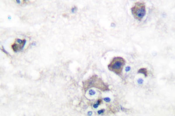 Polyclonal Rabbit anti-Human Peripherin Antibody (Ser454, IHC, WB)
