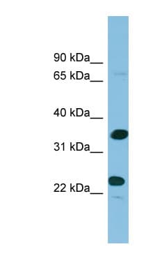 PDYN / ProDynorphin Antibody (aa143-192)