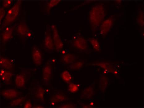IHC-plus™ PCCB Antibody (aa289-539)