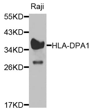 Polyclonal Rabbit anti-Human HLA-DPA1 Antibody (IHC, WB)
