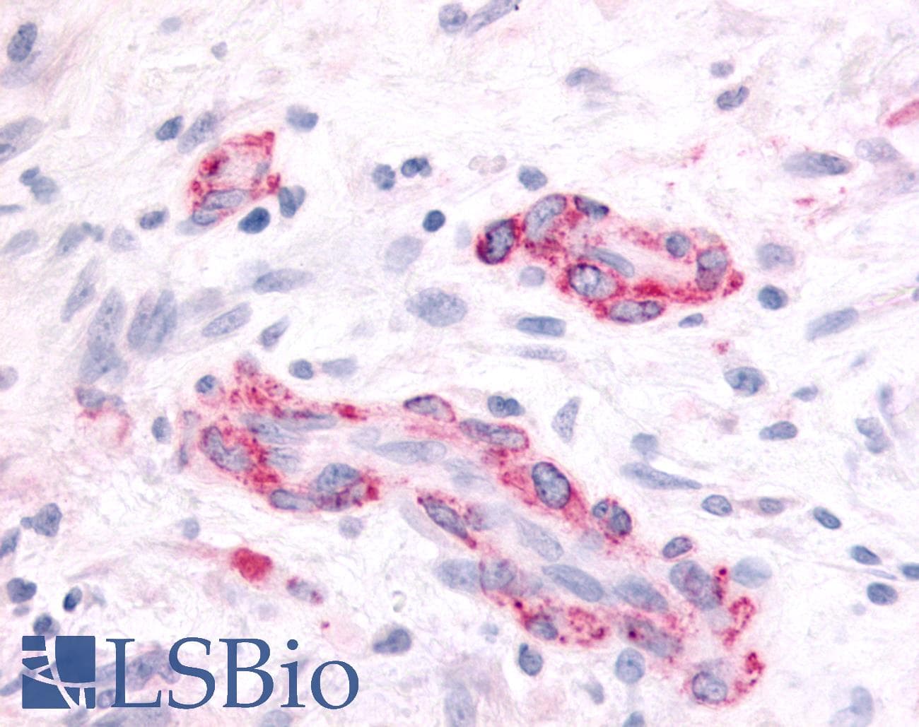 PathPlus™ SGK2 Antibody (Kinase Domain)