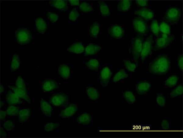 Monoclonal Mouse anti-Human TYK2 Antibody (clone 5A4, IF, WB)