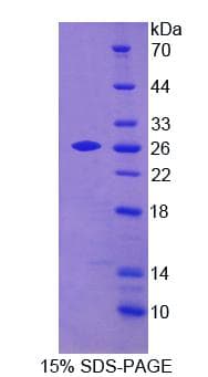 Human APLP2 Protein (Recombinant His-T7)