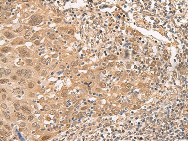 Polyclonal Rabbit anti-Human ISCU Antibody (IHC)