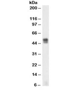 GFAP Antibody (clone SPM248)