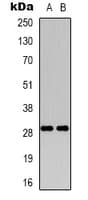 RAB34 Antibody (C-Terminus)