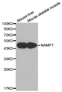 Polyclonal Rabbit anti-Human NAMPT / Visfatin Antibody (IHC, IF, WB)