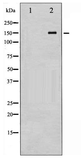 NOS3 / eNOS Antibody (phospho-Thr494)