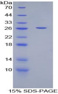 Bovine TREM1 Protein (Recombinant His-T7)