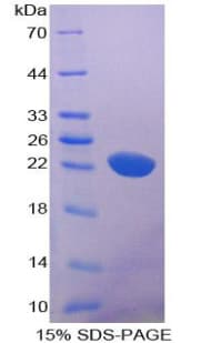 Rat CD6 Protein (Recombinant His-T7)