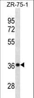 CHORDC1 / CHP1 Antibody (aa127-156)