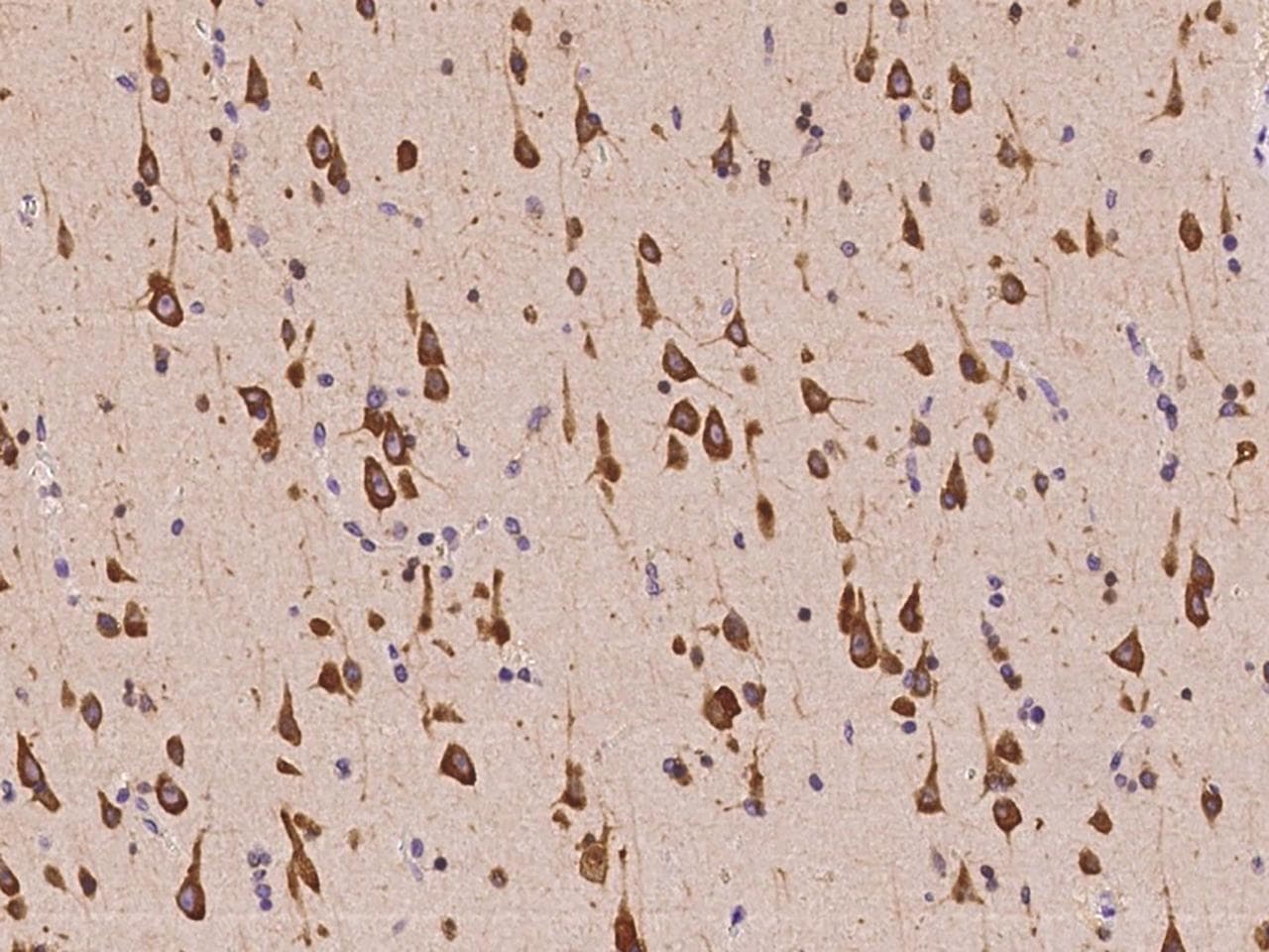SDCCAG1 / NEMF Antibody