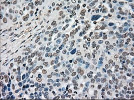 Monoclonal Mouse anti-Human MAP2K4 / MKK4 Antibody (clone OTI2D5, IHC, IF, WB)