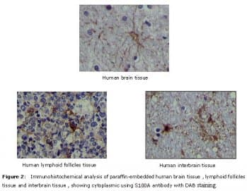 S100A Protein Antibody (clone 2C8B8, 2C8E8)
