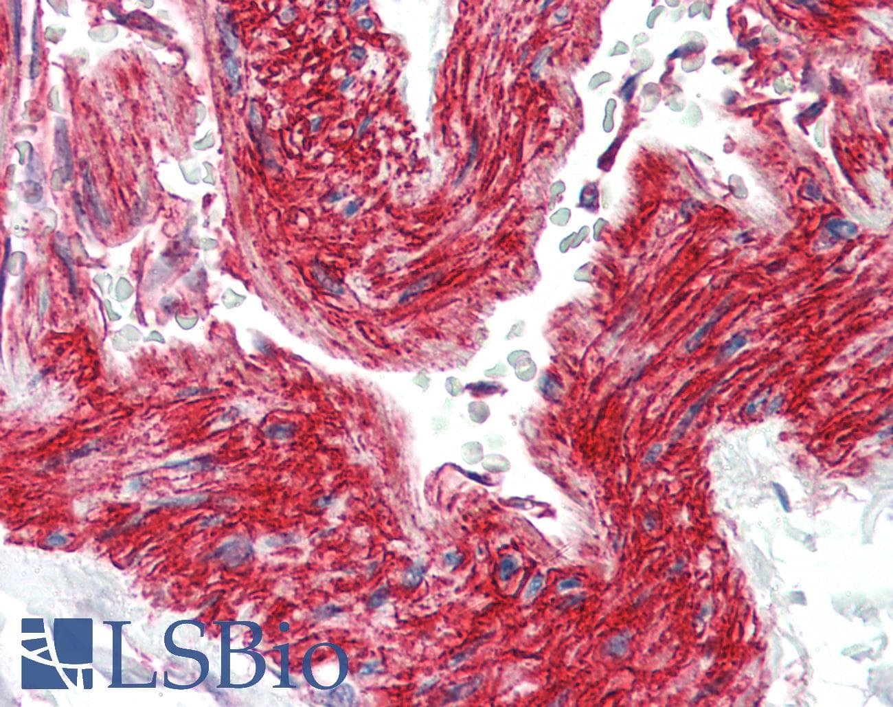 IHC-plus™ ITGB1 / Integrin Beta 1 / CD29 Antibody