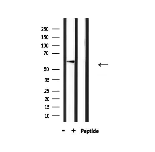 Polyclonal Rabbit anti-Human HFH-4 / FOXJ1 Antibody (IHC, IF, WB)
