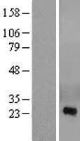CRISP2 / TSP1 Protein (Over-Expression Lysate Myc-DDK (Flag))
