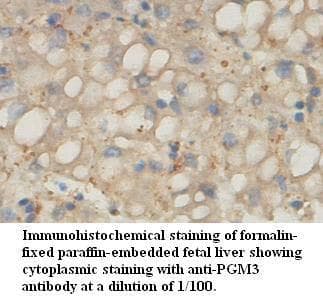 Polyclonal Rabbit anti-Human PGM3 Antibody (aa61-318, IHC, WB)