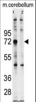 UBQLN1 / Ubiquilin Antibody (aa40-70)