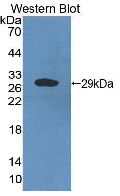 CRISP2 / TSP1 Antibody (aa22-240)