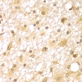 RUFY2 Antibody