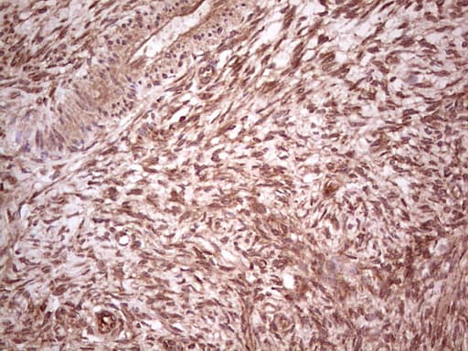 UBE2D2 / UBCH5B Antibody (clone OTI2C2, Carrier-free)