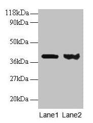 Polyclonal Rabbit anti-Human ARHGDIA / RHOGDI Antibody (IHC, WB)