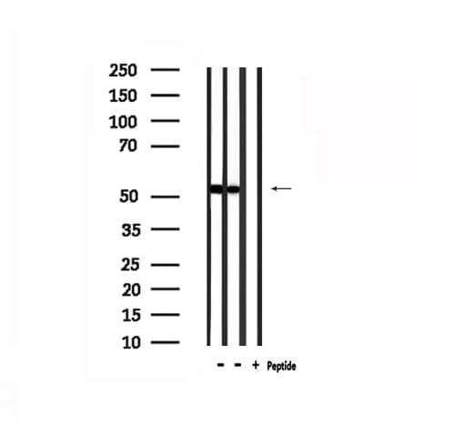 CNR1 / CB1 Antibody