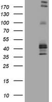 FCER2 / CD23 Antibody (clone OTI2B6)
