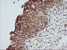 MAP2K1 / MKK1 / MEK1 Antibody (clone OTI7E2)