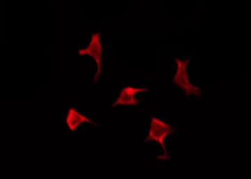 Polyclonal Rabbit anti-Human OR6A2 Antibody (IF, WB)