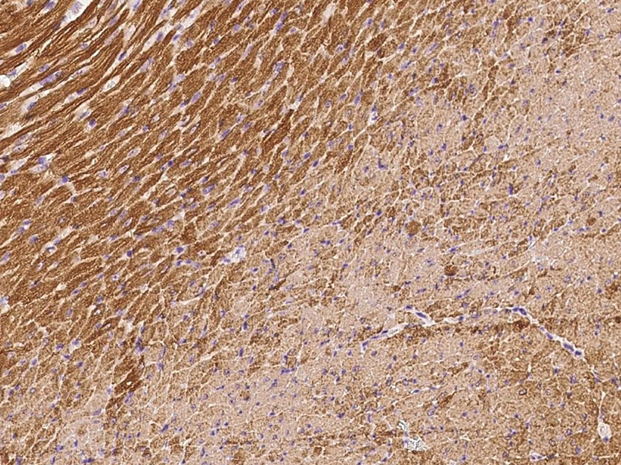 Polyclonal Rabbit anti-Mouse TNNC1 / Cardiac Troponin C Antibody (Preservative Free, IHC)