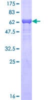 Human PDK4 Protein (Recombinant GST)