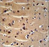 Polyclonal Rabbit anti-Human AXIN2 / Axin 2 Antibody (aa816-843, IHC, WB)