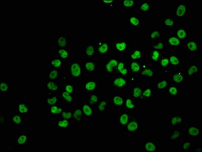 HIST1H2BN Antibody